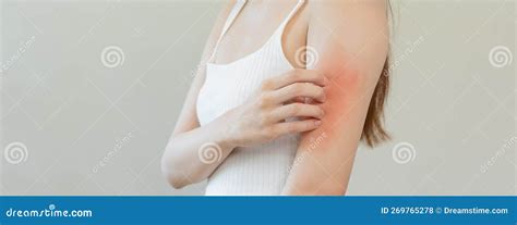 Dermatologia Giovane Donna Asiatica Allergia Allergica Da Reazione