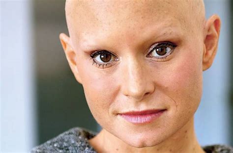 Alopecia Didnt Stop This Actress From Embracing Her Newfound Bald Beauty