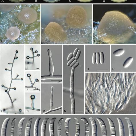 Fusarium Transvaalense Sp Nov A D Colonies On Pda Sna Oa And Cma