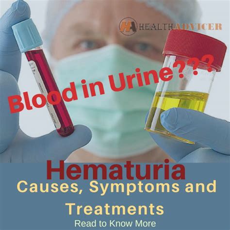 Blood In Urine (Hematuria) : Causes, Picture, Symptoms And Treatment