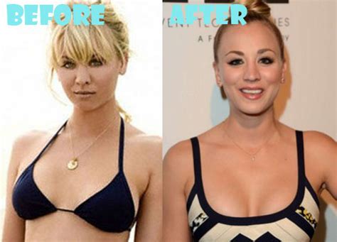 Kaley Cuoco Plastic Surgery Before and After Boob Job - Lovely Surgery