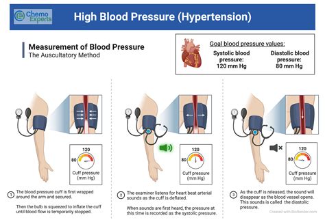 High Blood Pressure | ChemoExperts