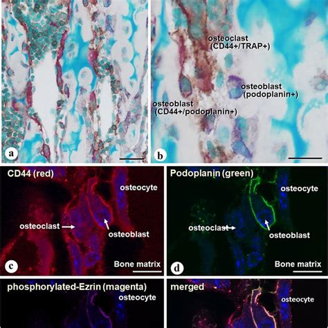 The Distribution Of Actin Filaments And Podoplanin In Osteoblasts And