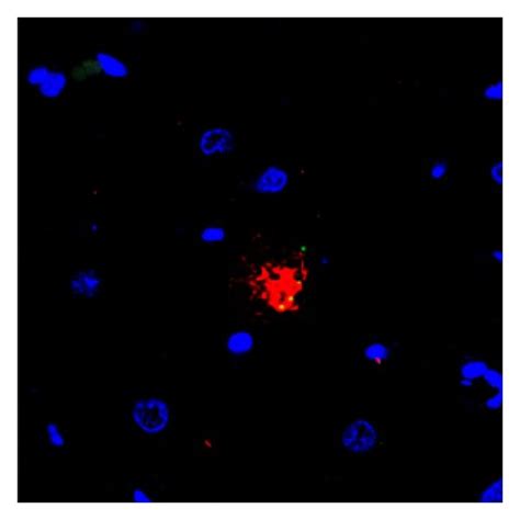 Double Labelling Immunofluorescence And Confocal Microscopy Show Download Scientific Diagram