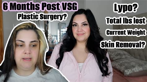 6 Month Post Op Gastric Sleeve Update Youtube