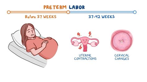 Preterm Birth Nursing