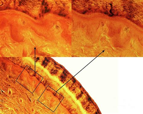 Meissner Corpuscle Photograph By Jose Calvo Science Photo Library