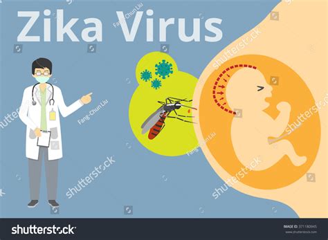 Zika Virus Infographic Background Explanation Virus Stock Vector