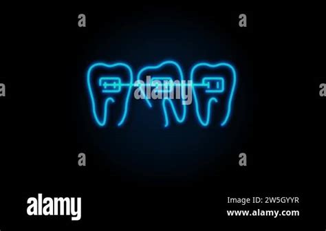 Correction Of Teeth With Orthodontic Braces Stages Of Teeth Alignment