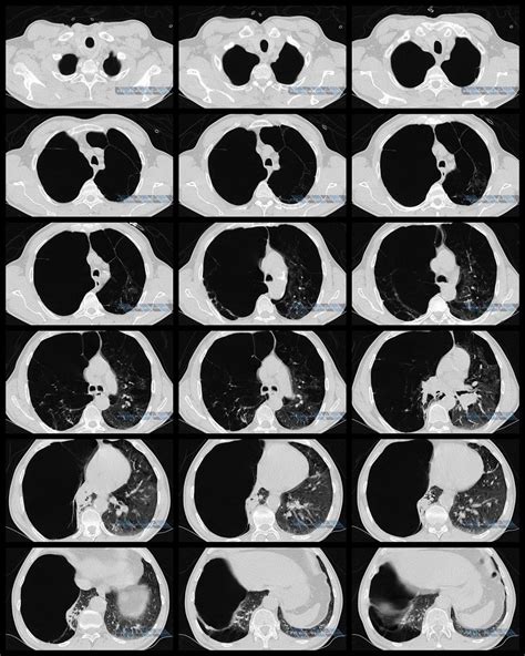 Radiology, Cases