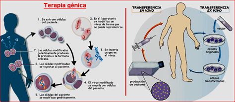 Enfermedades Isquémicas del Corazón Terapia Génica