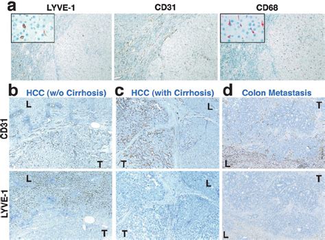 Lyve 1 Expression In Hepatic Blood Vessels Is Down Regulated In