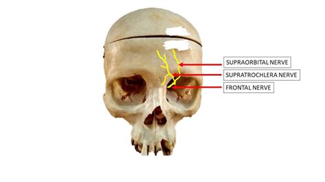 Figure Supratrochlear Nerve Contributee By Dr Pradip Chauhan Ms