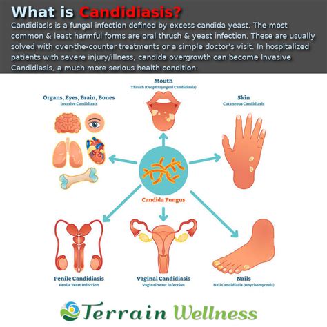 Invasive Candidiasis