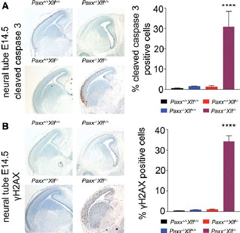 Increased Genomic Instability And Apoptosis In The Cns Of Paxx Xlf