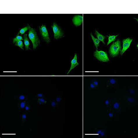 The In Vitro TsE Expression In BHK 21 Cells A The In Vitro TsE MRNA