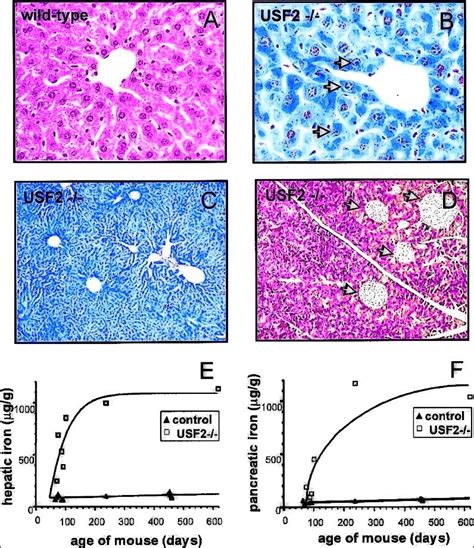 ️⃣ Iron Accumulation In Liver And Pancreas Of Usf2− − Mice Liver And Download Scientific