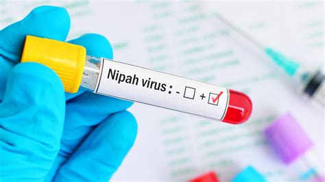 What is nipah virus and what are its symptoms and treatment | HealthShots