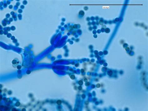 Fun With Microbiology (What's Buggin' You?): Penicillium species