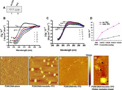 Effect of acetylation on the DNA condensation properties of TP2. A ,... | Download Scientific ...