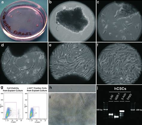 Primary Explant Culture From Human Atrial Explant And C Kit Pos Cardiac