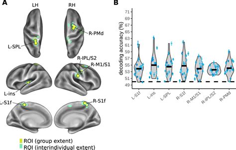 MVPA Results For Decoding Anatomical Touch Location Right Vs Left