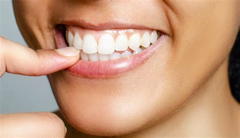 The Advantages And Disadvantages Of Dental Veneers Medicompare