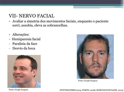 Exame Físico Neurologico PPT