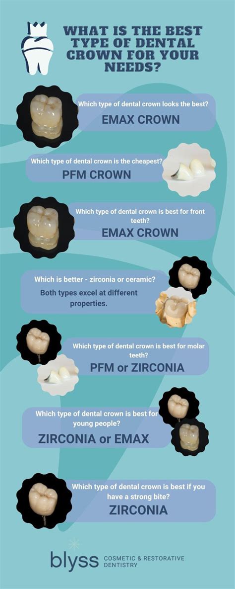 Types of Dental Crowns: Insider Tips to Choose the Best One for You