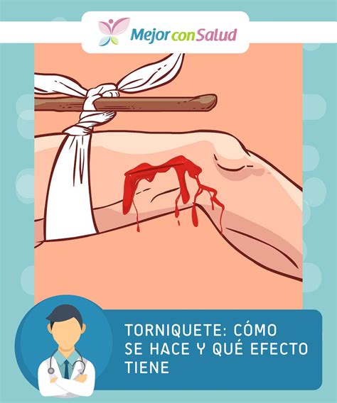 Torniquete: cómo se hace y qué efecto tiene | Imagenes de primeros auxilios, Cosas de enfermeria