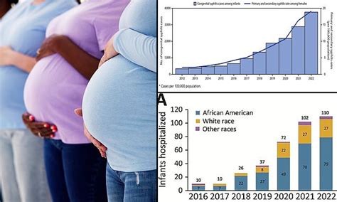 Rates Of Syphilis In Babies Have Risen 10 Fold In Past Decade To Record