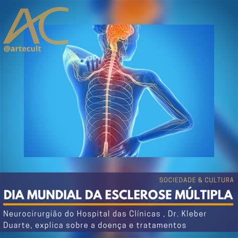 De Maio Dia Mundial Da Esclerose M Ltipla Neurocirurgi O Do