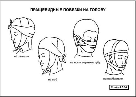 Повязки (Повязки)