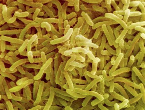 Cholera Bacteria Photograph By Ami Imagesscience Photo Library Pixels