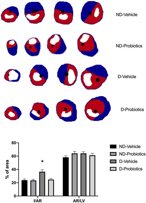 Upper Panel Representative Images Of Myocardial Infarction Observed In