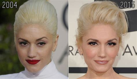 Gwen Stefani Nose Job Before After Photos Plastic Surgery Magazine