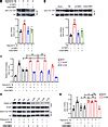 JCI TIMP2 Ameliorates Blood Brain Barrier Disruption In Traumatic