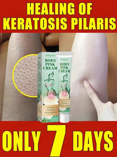 Peeling K Rperlotion Repariert Keratosis Pilaris Entfernt G Nsehaut Und