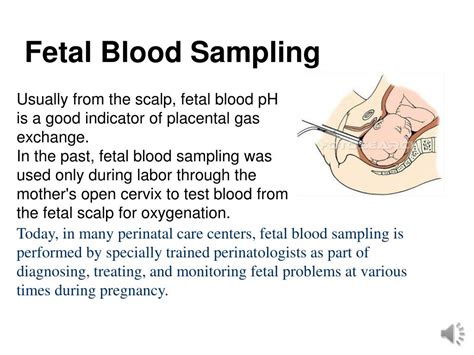 Ppt Fetal Monitoring Powerpoint Presentation Free Download Id1898600