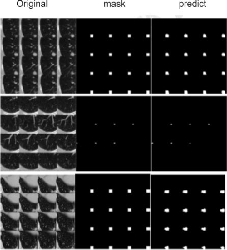 Figure 6 From Improved 3D Multiscale V Net Network Based Segmentation