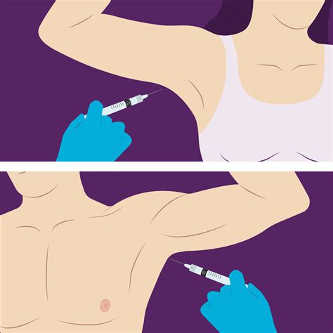 Botox On Armpits No More Sweat Botox For Underarm Hyperhidrosis