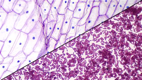 The difference between prokaryotic and eukaryotic cells? | Live Science