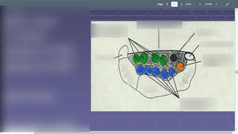 Carpal Tunnel Diagram Quizlet