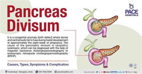 Inguinal Hernia Signs And Symptoms, Types, Causes, Risk, 50% OFF