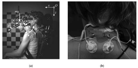 Emg Test Neck Shoulder Pain Eatasl