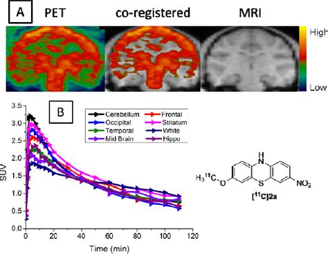 Figure 3 From Radiosynthesis And In Vivo Evaluation Of Two PET