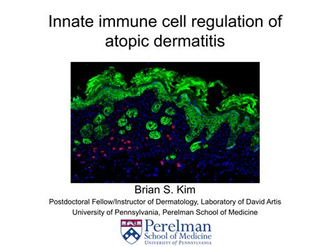 Pdf Innate Immune Regulation Of Atopic Dermatitis