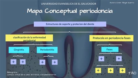 MAPA CONCEPTUAL PERIODONCIA