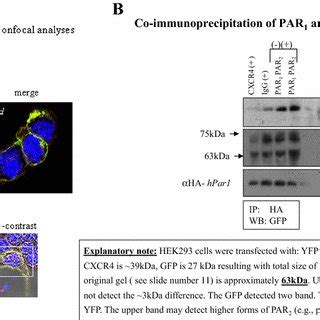 Co Localization Of Par And Par A Confocal Immunofluorescence