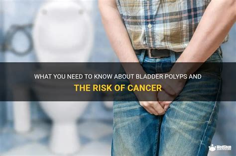 What You Need To Know About Bladder Polyps And The Risk Of Cancer Medshun